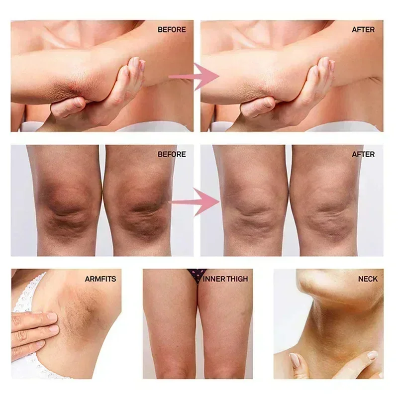 Collagen Underarm Whitening Cr - Skincare Whitening 评论和价格