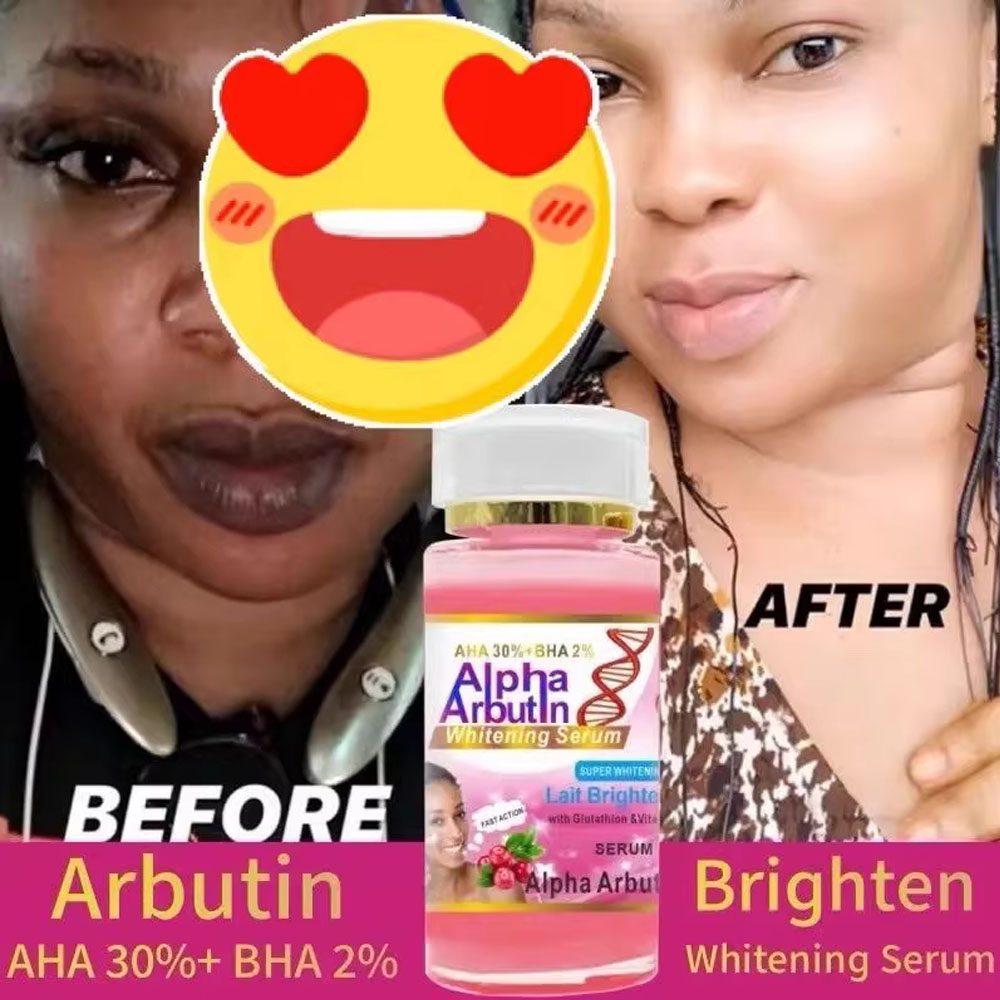 Alpha Arbutin Serum AHA 30%+ B - Alpha Arbutin Serum 评论和价格