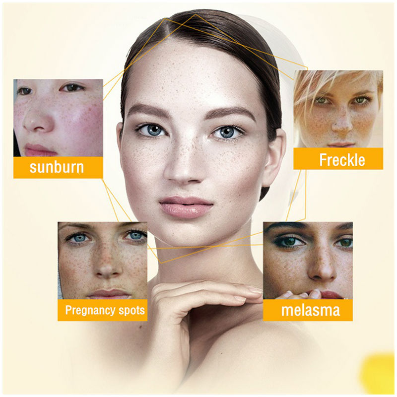 Dimollaure Whitening Freckle C - Skincare Whitening 评论和价格