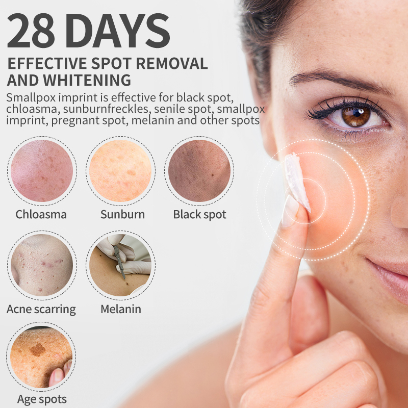 Dimollaure Whitening Freckle C - Skincare Whitening 评论和价格