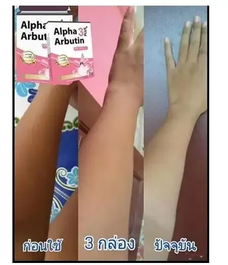 Alpha Arbutin 3 Plus Powder Mi - Alpha Arbutin Serum 评论和价格